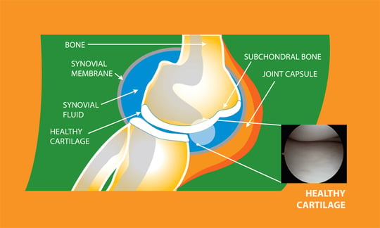 healthy cartilage