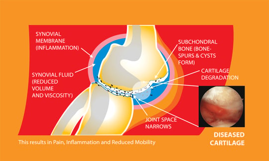 diseased cartilage